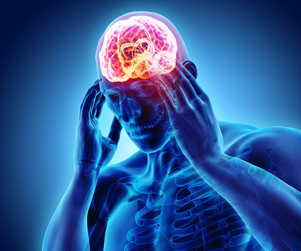Customized Headache & Longevity Medicine | Brain Wellness MD